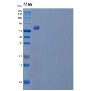 Recombinant Human Polypeptide GalNac Transferase 3/GALNT3 Protein(C-6His),Recombinant Human Polypeptide GalNac Transferase 3/GALNT3 Protein(C-6His)