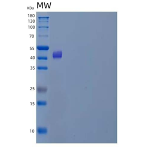 Recombinant Human Uroporphyrinogen Decarboxylase/UROD Protein(N-6His)