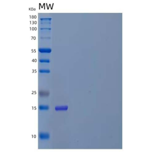 Recombinant Human Amyloid β A4 Precursor Protein-Binding A3/APBA3/X11-γ Protein(C-6His)