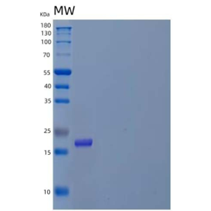 Recombinant Human Prefoldin Subunit 2/PFDN2 Protein(N-6His),Recombinant Human Prefoldin Subunit 2/PFDN2 Protein(N-6His)