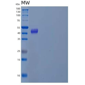 Recombinant Human DNA Polymerase δ Subunit 2/POLD2 Protein(C-6His)