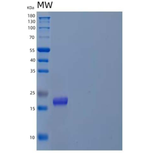 Recombinant Human Prefoldin Subunit 4/PFDN4 Protein(N-6His)