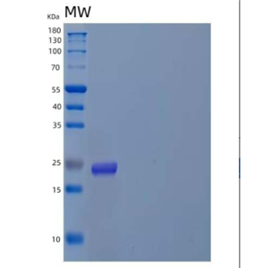 Recombinant Human Angiopoietin-Like Protein 8/ANGPTL8/Betatrophin Protein(C-6His)