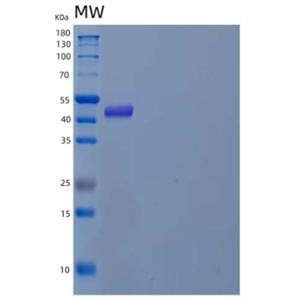 Recombinant Human Pregnancy-Specific β-1-Glycoprotein 1/PSG1 Protein(C-6His)