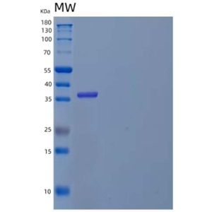 Recombinant Human Interleukin-5 Receptor Subunit Alpha/IL-5 Rα Protein(C-6His)