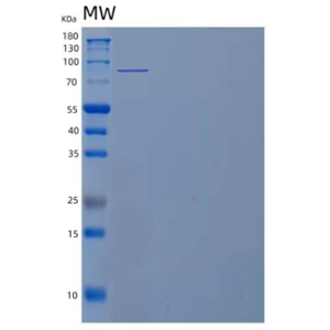 Recombinant Human Angiotensin-Converting Enzyme 2/ACE-2 Protein(C-6His)