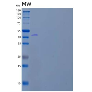 Recombinant Human Angiotensinogen/Serpin A8/AGT Protein(C-6His)