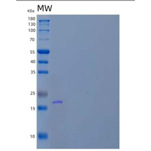 Recombinant Human dUTP Pyrophosphatase/dUTPase Protein.