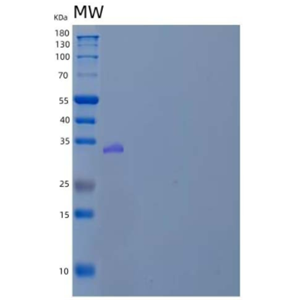 Recombinant Human Pregnancy-Specific β-1-Glycoprotein 5/PSG5 Protein(C-6His),Recombinant Human Pregnancy-Specific β-1-Glycoprotein 5/PSG5 Protein(C-6His)