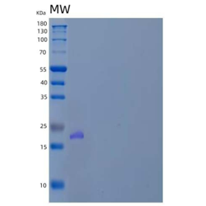 Recombinant Human Visinin-Like Protein 1/VILIP/VSNL1 Protein(N-6His),Recombinant Human Visinin-Like Protein 1/VILIP/VSNL1 Protein(N-6His)