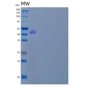 Recombinant Mouse Plasma Glutamate Carboxypeptidase/PGCP Protein(C-6His)