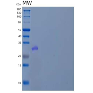 Recombinant Human Ankyrin Repeat and SOCS Box Protein 13/ASB13 Protein(N-6His)