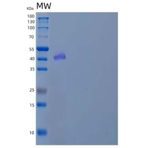 Recombinant Human D-β-Hydroxybutyrate Dehydrogenase Mitochondrial/BDH1 Protein(N-6His)