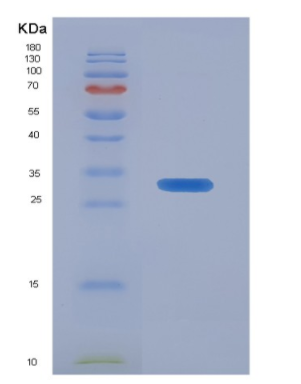 Recombinant Insulin Like Growth Factor 2 mRNA Binding Protein 2 (IGF2BP2),Recombinant Insulin Like Growth Factor 2 mRNA Binding Protein 2 (IGF2BP2)