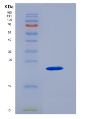 Eukaryotic Interleukin 10 (IL10),Eukaryotic Interleukin 10 (IL10)