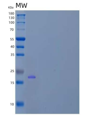 Recombinant Human EIF1A, X-Chromosomal/EIF1AX Protein(N-6His),Recombinant Human EIF1A, X-Chromosomal/EIF1AX Protein(N-6His)