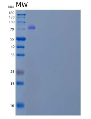 Recombinant Human Inter-α-Trypsin Inhibitor Heavy Chain H3/ITIH3 Protein(C-6His),Recombinant Human Inter-α-Trypsin Inhibitor Heavy Chain H3/ITIH3 Protein(C-6His)
