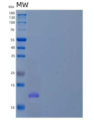 Recombinant Human WW Domain-Binding Protein 2/WBP2 Protein(N-6His),Recombinant Human WW Domain-Binding Protein 2/WBP2 Protein(N-6His)