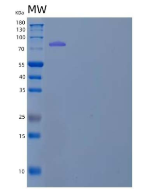 Recombinant Mouse Semaphorin 4C/SEMA4C Protein(C-Fc),Recombinant Mouse Semaphorin 4C/SEMA4C Protein(C-Fc)