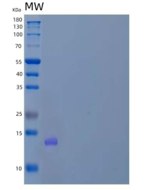 Recombinant Human Proprotein Convertase Subtilisin/Kexin Type 9/PCSK9 Protein(C-6His/HA/AVI),Recombinant Human Proprotein Convertase Subtilisin/Kexin Type 9/PCSK9 Protein(C-6His/HA/AVI)