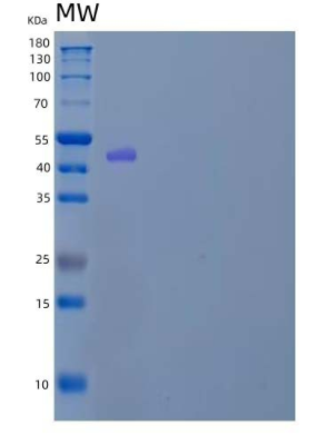 Recombinant Mouse Serpin D1/Heparin Cofactor II/HCF2 Protein(C-6His),Recombinant Mouse Serpin D1/Heparin Cofactor II/HCF2 Protein(C-6His)