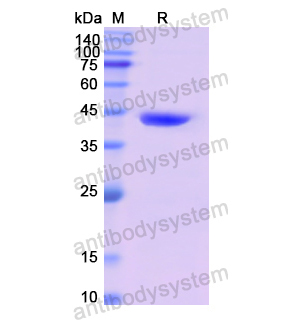 重组CD4蛋白,Recombinant Human CD4, N-His