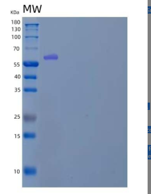 Recombinant Human Karyopherin Subunit α-2 /KPNA2/IPOA1 Protein(N-6His),Recombinant Human Karyopherin Subunit α-2 /KPNA2/IPOA1 Protein(N-6His)