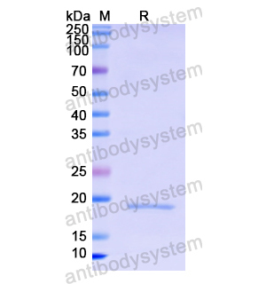 重組CD8A蛋白,Recombinant Human CD8A, N-His