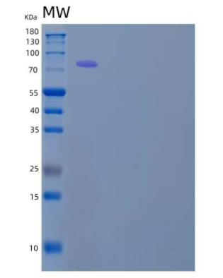 Recombinant Human Ephrin B Receptor 1/EphB1 Protein(C-Fc),Recombinant Human Ephrin B Receptor 1/EphB1 Protein(C-Fc)