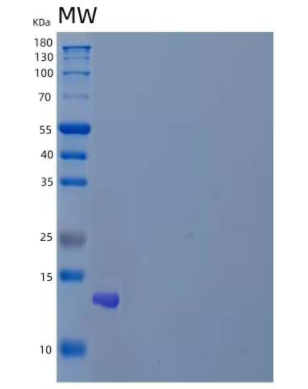 Recombinant Human Krueppel-Like Factor 6/KLF6 Protein,Recombinant Human Krueppel-Like Factor 6/KLF6 Protein