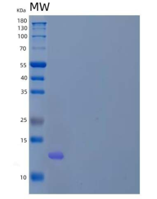 Recombinant Human Zinc Finger BED Domain-Containing Protein 1/ZBED1 Protein(C-6His),Recombinant Human Zinc Finger BED Domain-Containing Protein 1/ZBED1 Protein(C-6His)