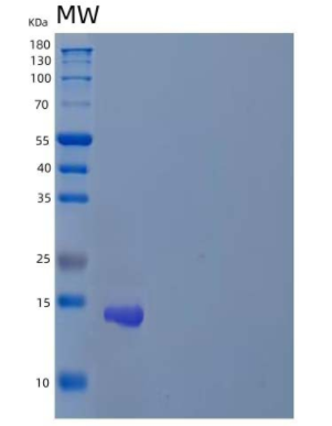 Recombinant Human Zinc Finger Protein 75A/ZNF75A Protein(N-6His),Recombinant Human Zinc Finger Protein 75A/ZNF75A Protein(N-6His)