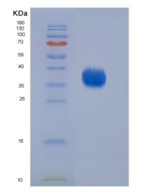 Eukaryotic Cluster Of Differentiation 2 (CD2),Eukaryotic Cluster Of Differentiation 2 (CD2)