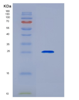 Recombinant Cluster Of Differentiation 72 (CD72),Recombinant Cluster Of Differentiation 72 (CD72)