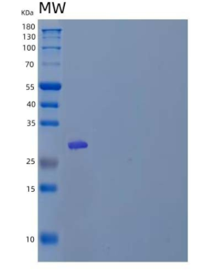 Recombinant Human ETS1/EWSR2/P54 Protein(N-6His),Recombinant Human ETS1/EWSR2/P54 Protein(N-6His)