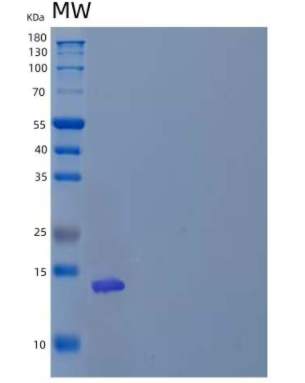 Recombinant Human T cell Immunoreceptor with Ig and ITIM domains Protein/VSTM3,Recombinant Human T cell Immunoreceptor with Ig and ITIM domains Protein/VSTM3