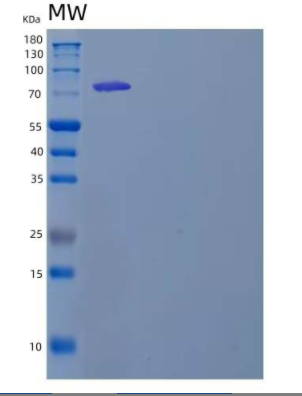 Recombinant Mouse Transglutaminase 2/TGM2 Protein(C-6His),Recombinant Mouse Transglutaminase 2/TGM2 Protein(C-6His)