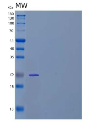 Recombinant Human Eukaryotic Translation Initiation Factor 4E/EIF4E Protein,Recombinant Human Eukaryotic Translation Initiation Factor 4E/EIF4E Protein