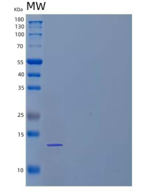 Recombinant Mouse Transforming Growth Factor β-2/TGFβ2/TGFB2 Protein,Recombinant Mouse Transforming Growth Factor β-2/TGFβ2/TGFB2 Protein
