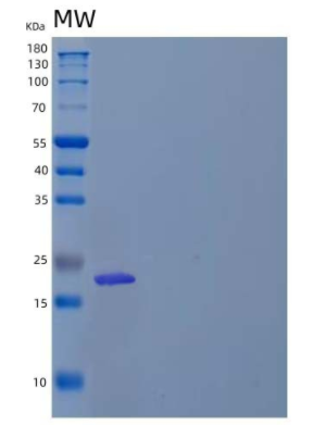 Recombinant Human BNIP3/NIP3 Protein(N-6His),Recombinant Human BNIP3/NIP3 Protein(N-6His)