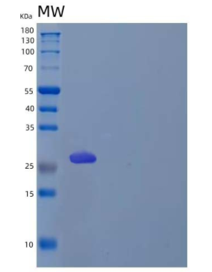 Recombinant Human Kallikrein 11 Protein,Recombinant Human Kallikrein 11 Protein