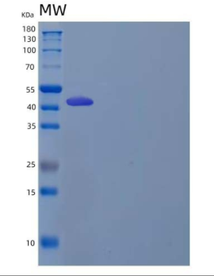 Recombinant Human LIM and Cysteine-Rich Domains Protein 1/LMCD1/Dyxin Protein(N, C-6His),Recombinant Human LIM and Cysteine-Rich Domains Protein 1/LMCD1/Dyxin Protein(N, C-6His)