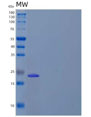 Recombinant Human RANK L/TRANCE/TNFSF11 Protein(N-6His),Recombinant Human RANK L/TRANCE/TNFSF11 Protein(N-6His)