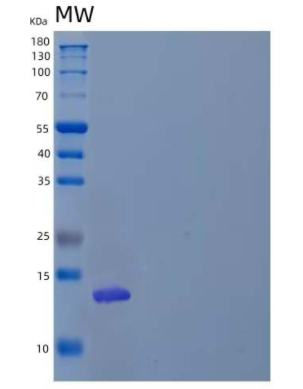 Recombinant Human Pterin-4-α-Carbinolamine Dehydratase/PHS/PCBD1 Protein(N-6His),Recombinant Human Pterin-4-α-Carbinolamine Dehydratase/PHS/PCBD1 Protein(N-6His)