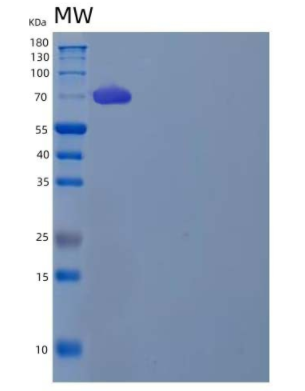 Recombinant Human Leukotriene A-4 Hydrolase/LTA4H Protein(C-6His),Recombinant Human Leukotriene A-4 Hydrolase/LTA4H Protein(C-6His)