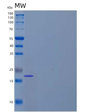 Recombinant Human ?3-Glutamylaminecyclotransferase/GGACT Protein(N-6His),Recombinant Human ?3-Glutamylaminecyclotransferase/GGACT Protein(N-6His)