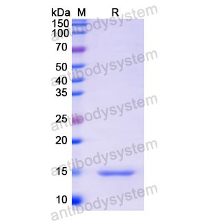 重组PIIINP/COL3A1蛋白,Recombinant Human PIIINP/COL3A1, N-His