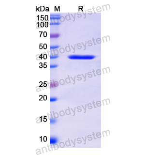 重组KRT14蛋白,Recombinant Human KRT14, N-His