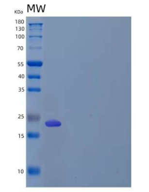 Recombinant Human Butyrophilin 3A2/BTN3A2 Protein(C-6His),Recombinant Human Butyrophilin 3A2/BTN3A2 Protein(C-6His)