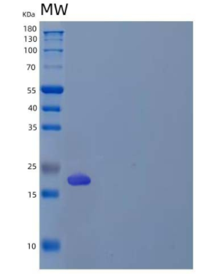 Recombinant Human Regenerating Islet-Derived Protein 3-γ/Reg3γ/REG3G Protein(C-6His),Recombinant Human Regenerating Islet-Derived Protein 3-γ/Reg3γ/REG3G Protein(C-6His)